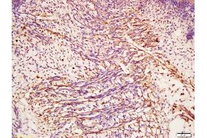 CHI3L1 antibody  (AA 330-381)