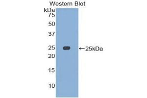 Detection of Recombinant SMC3, Human using Polyclonal Antibody to Structural Maintenance Of Chromosomes Protein 3 (SMC3)