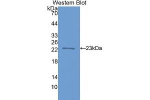 Western Blotting (WB) image for anti-Fast Skeletal Troponin I (TNNI2) (AA 1-182) antibody (ABIN1078623) (TNNI2 antibody  (AA 1-182))