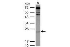 Image no. 2 for anti-Cytoglobin (CYGB) (AA 1-190) antibody (ABIN1501883) (CYGB antibody  (AA 1-190))