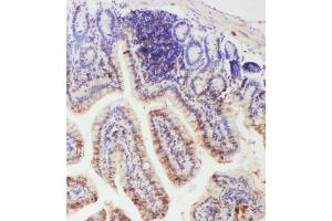 IHC analysis of IL-18 using anti- IL-18 antibody . (IL-18 antibody  (AA 36-192))