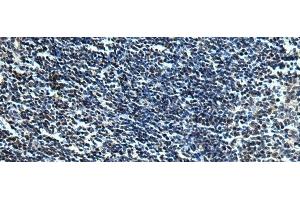 Immunohistochemistry of paraffin-embedded Human tonsil tissue using SLC2A12 Polyclonal Antibody at dilution of 1:30(x200) (GLUT12 antibody)