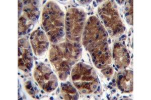 CTGF antibody immunohistochemistry analysis in formalin fixed and paraffin embedded human stomach tissue. (CTGF antibody  (AA 134-159))