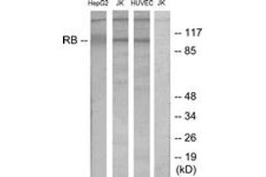 Western blot analysis of extracts from HepG2/Jurkat/HuvEc cells, using Retinoblastoma (Ab-780) Antibody. (Retinoblastoma Protein (Rb) antibody  (AA 751-800))