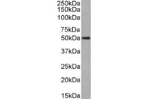 Western Blot using anti-CD63 antibody NK-1-C3. (Recombinant CD63 antibody)
