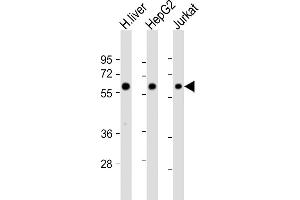 All lanes : Anti-CYP2E1 Antibody (Center) at 1:4000 dilution Lane 1: human liver lysate Lane 2: HepG2 whole cell lysate Lane 3: Jurkat whole cell lysate Lysates/proteins at 20 μg per lane. (CYP2E1 antibody  (AA 166-198))