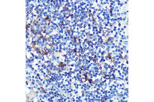 Immunohistochemistry of paraffin-embedded human spleen using HLA-DRA Rabbit mAb (ABIN7267758) at dilution of 1:100 (40x lens). (HLA-DRA antibody)