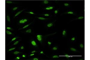Immunofluorescence of monoclonal antibody to TCEA3 on HeLa cell. (TCEA3 antibody  (AA 1-348))
