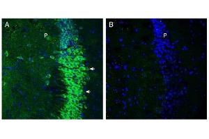 Expression of SLC6A15 in mouse hippocampus.