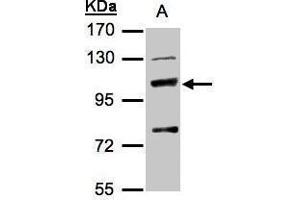 WB Image Sample(30 μg of whole cell lysate) A:Hep G2, 7. (MANBA antibody)