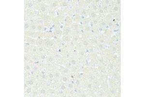 Immunohistochemistry of paraffin-embedded rat liver using TRIM15 antibody (ABIN4905492) at dilution of 1:100 (40x lens). (TRIM15 antibody)
