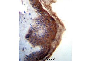 Immunohistochemistry (IHC) image for anti-Interleukin 1 delta (FIL1d) antibody (ABIN5016258) (FIL1d antibody)