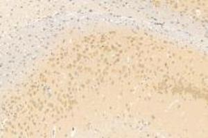 Immunohistochemistry analysis of paraffin-embedded mouse brain using,Neuroligin 3 (ABIN7074816) at dilution of 1: 1200 (Neuroligin 3 antibody)