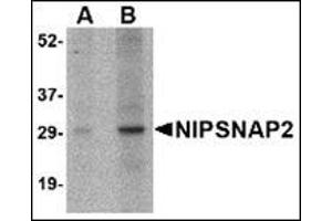 Western blot analysis of NIPSNAP2 in human skeletal muscle tissue lysate with this product at (A) 1 and (B) 2 μg/ml.