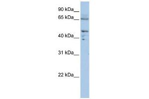 DLAT antibody used at 1 ug/ml to detect target protein. (DLAT antibody  (C-Term))