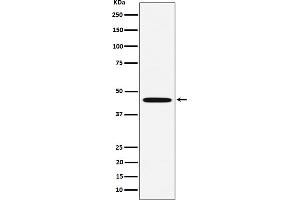 Western blot analysis of MC5 Receptor expression in HeLa cell lysate.