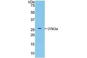 Detection of Recombinant FGFRL1, Human using Polyclonal Antibody to Fibroblast Growth Factor Receptor Like Protein 1 (FGFRL1) (FGFRL1 antibody  (AA 168-378))