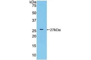 Detection of Recombinant FGFRL1, Human using Polyclonal Antibody to Fibroblast Growth Factor Receptor Like Protein 1 (FGFRL1)