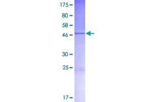 Stromal Antigen 3-Like 1 (STAG3L1) (AA 1-205) protein (GST tag)