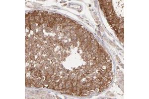 Immunohistochemical staining (Formalin-fixed paraffin-embedded sections) of human testis with MAPRE1 polyclonal antibody  shows strong cytoplasmic positivity in cells of seminiferous ducts. (MAPRE1 antibody)