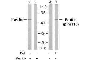 Image no. 1 for anti-Paxillin (PXN) (pTyr118) antibody (ABIN196776) (Paxillin antibody  (pTyr118))
