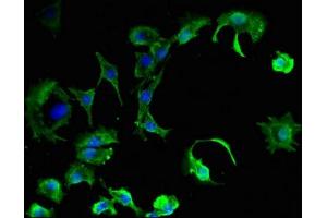 Immunofluorescent analysis of MCF-7 cells using ABIN7146610 at dilution of 1:100 and Alexa Fluor 488-congugated AffiniPure Goat Anti-Rabbit IgG(H+L) (PKIB antibody  (AA 1-77))