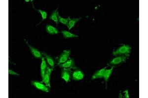 Immunofluorescent analysis of Hela cells using ABIN7147724 at dilution of 1:100 and Alexa Fluor 488-congugated AffiniPure Goat Anti-Rabbit IgG(H+L) (CHD5 antibody  (AA 1600-1699))