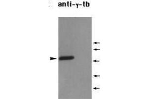 Western Blotting (WB) image for anti-Tubulin, gamma 1 (TUBG1) (C-Term) antibody (ABIN2451983) (TUBG1 antibody  (C-Term))