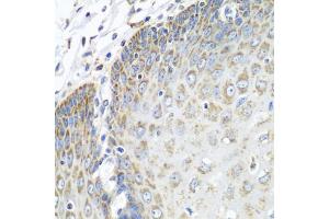 Immunohistochemistry of paraffin-embedded human esophagus using TMOD3 antibody (ABIN5972684) at dilution of 1/100 (40x lens).