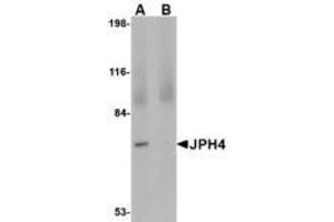 Image no. 1 for anti-Junctophilin 4 (JPH4) (C-Term) antibody (ABIN341700) (Junctophilin 4 antibody  (C-Term))