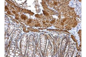 IHC-P Image alpha smooth muscle Actin antibody detects alpha smooth muscle Actin protein at cytosol on mouse colon by immunohistochemical analysis. (Smooth Muscle Actin antibody  (N-Term))