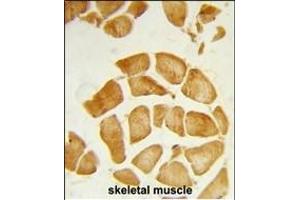 Formalin-fixed and paraffin-embedded human skeletal muscle reacted with ANP32A Antibody (C-term), which was peroxidase-conjugated to the secondary antibody, followed by DAB staining. (PHAP1 antibody  (C-Term))