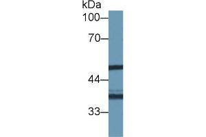 Western blot analysis of Human HeLa cell lysate, using Mouse NAT1 Antibody (1 µg/ml) and HRP-conjugated Goat Anti-Rabbit antibody (