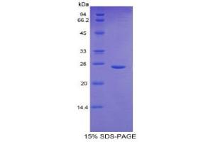 SDS-PAGE (SDS) image for Glutamate-Cysteine Ligase, Catalytic Subunit (GCLC) (AA 435-636) protein (His tag) (ABIN2121127)