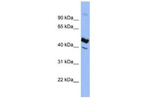 SERPIND1 antibody used at 1 ug/ml to detect target protein.