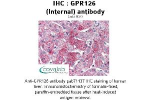 Image no. 1 for anti-G Protein-Coupled Receptor 126 (GPR126) (Internal Region) antibody (ABIN1734924) (G Protein-Coupled Receptor 126 antibody  (Internal Region))