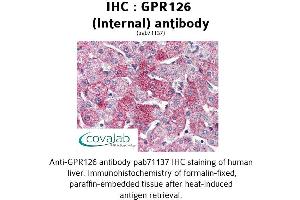 Image no. 1 for anti-G Protein-Coupled Receptor 126 (GPR126) (Internal Region) antibody (ABIN1734924)