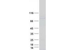 Validation with Western Blot