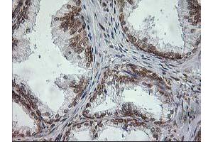 Image no. 1 for anti-Signal Sequence Receptor, alpha (SSR1) antibody (ABIN1501149) (SSR1 antibody)