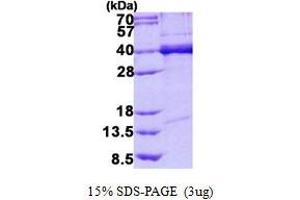 Image no. 1 for TAR DNA Binding Protein (TARDBP) protein (His tag) (ABIN1098222) (TARDBP Protein (His tag))