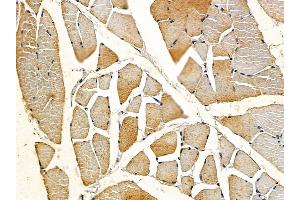 ABIN6257810 and ABIN6275794 at 1/100 staining rat muscle tissue by IHC-P. (MYL7 antibody  (Internal Region))