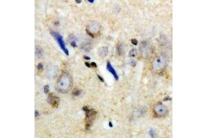 Immunohistochemical analysis of LC3A staining in human brain formalin fixed paraffin embedded tissue section. (MAP1LC3A antibody)