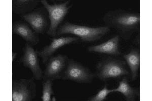 Immunofluorescent staining of HeLa (ATCC CCL-2) cells. (Crk antibody  (AA 102-304))