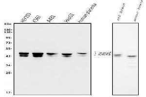 Western blot analysis of hnRNP D/AUF1/HNRNPD using anti-hnRNP D/AUF1/HNRNPD antibody (ABIN7602591). (HNRNPD/AUF1 antibody  (AA 88-246))