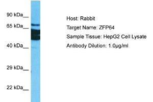 Host: Rabbit Target Name: ZFP64 Sample Tissue: Human HepG2 Whole Cell Antibody Dilution: 1ug/ml (ZFP64 antibody  (C-Term))