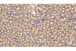 Immunohistochemistry (IHC) image for anti-Apolipoprotein A-IV (APOA4) (AA 135-281) antibody (ABIN7438073)
