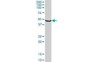 UPB1 monoclonal antibody (M09), clone 3F12. (UPB1 antibody  (AA 285-384))