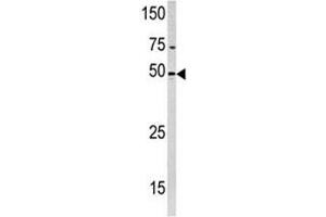 Western blot analysis of PXK antibody and HeLa lysate (PXK antibody  (AA 221-251))
