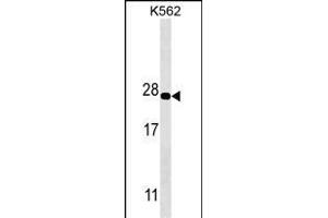 PS Antibody (ABIN1539887 and ABIN2843849) western blot analysis in K562 cell line lysates (35 μg/lane). (PSMA5 antibody)