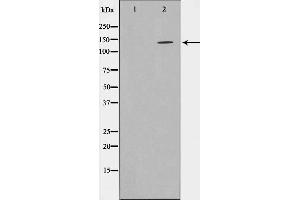 Western blot analysis on HepG2 cell lysate using SHIP1 Antibody,The lane on the left is treated with the antigen-specific peptide. (INPP5D antibody  (C-Term))